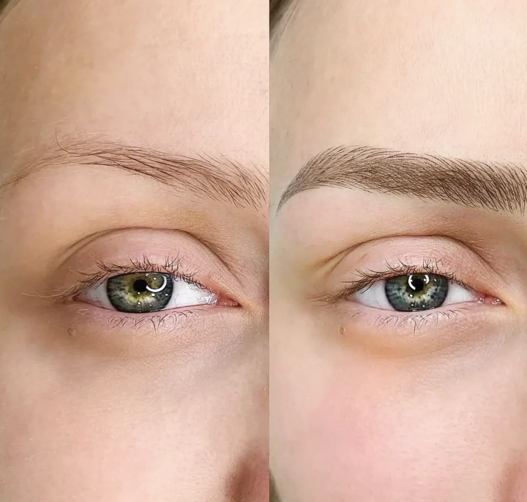 cosmetic tattooist melbourne