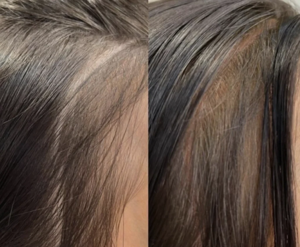 hair line tattoo