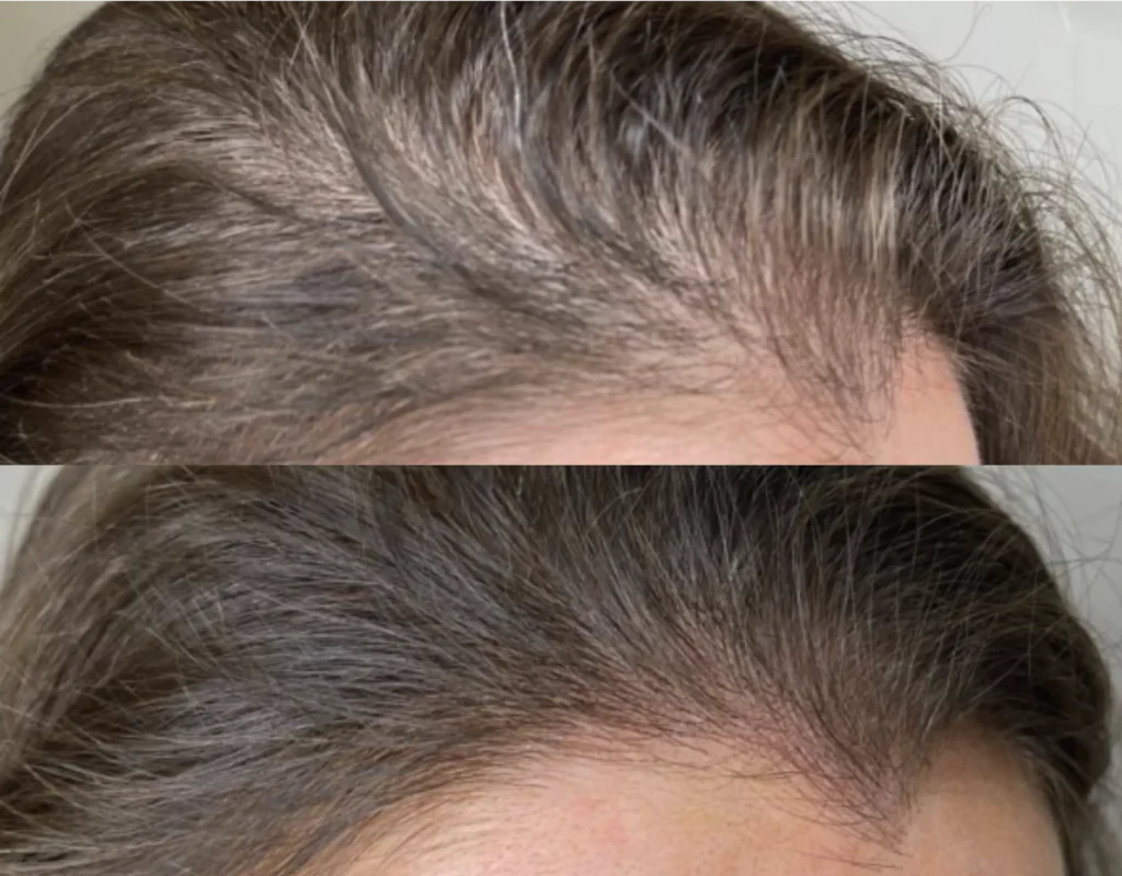 hair tattoo brisbane