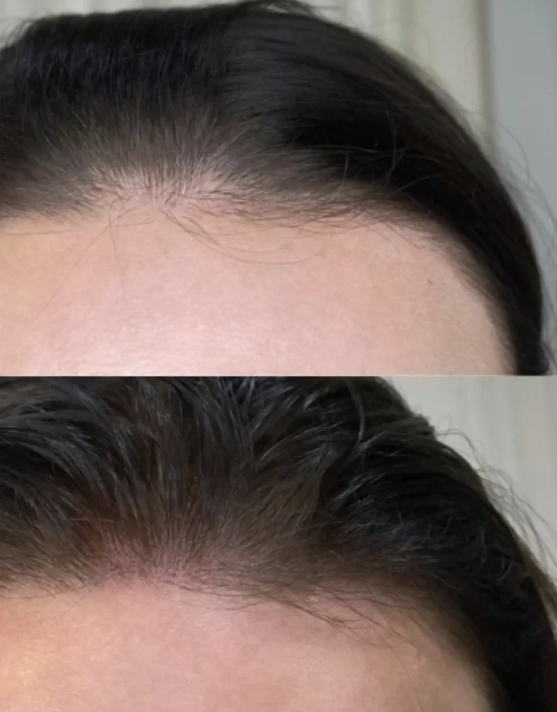 micropigmentation hair