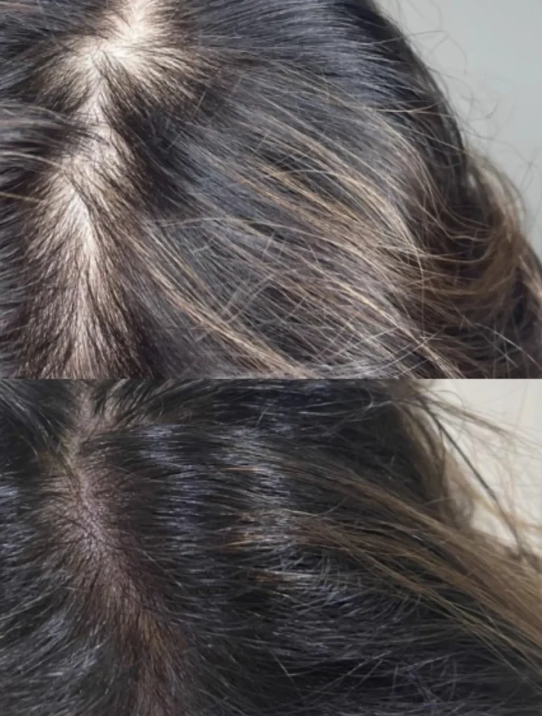 pigmentation hair