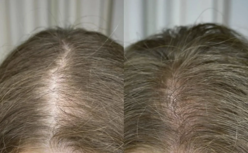 tattooed hair